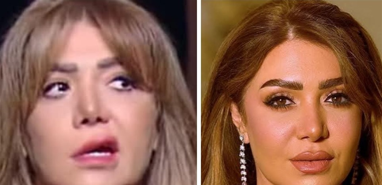 بعد أن أُصيبت بالعصب السابع.. إعلامية عربية ترد على منتقديها: اللي مش عاجبه شكلي ميلزمنيش