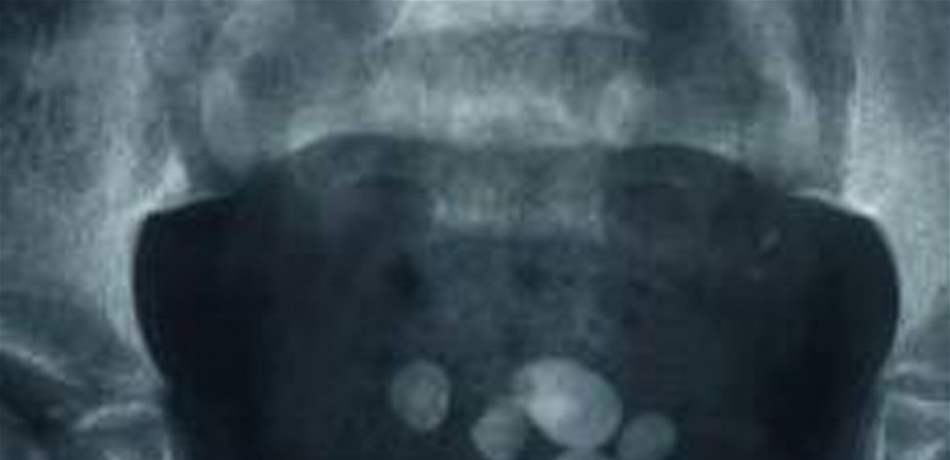 Doc-P-535425-636798652533665569.jpg