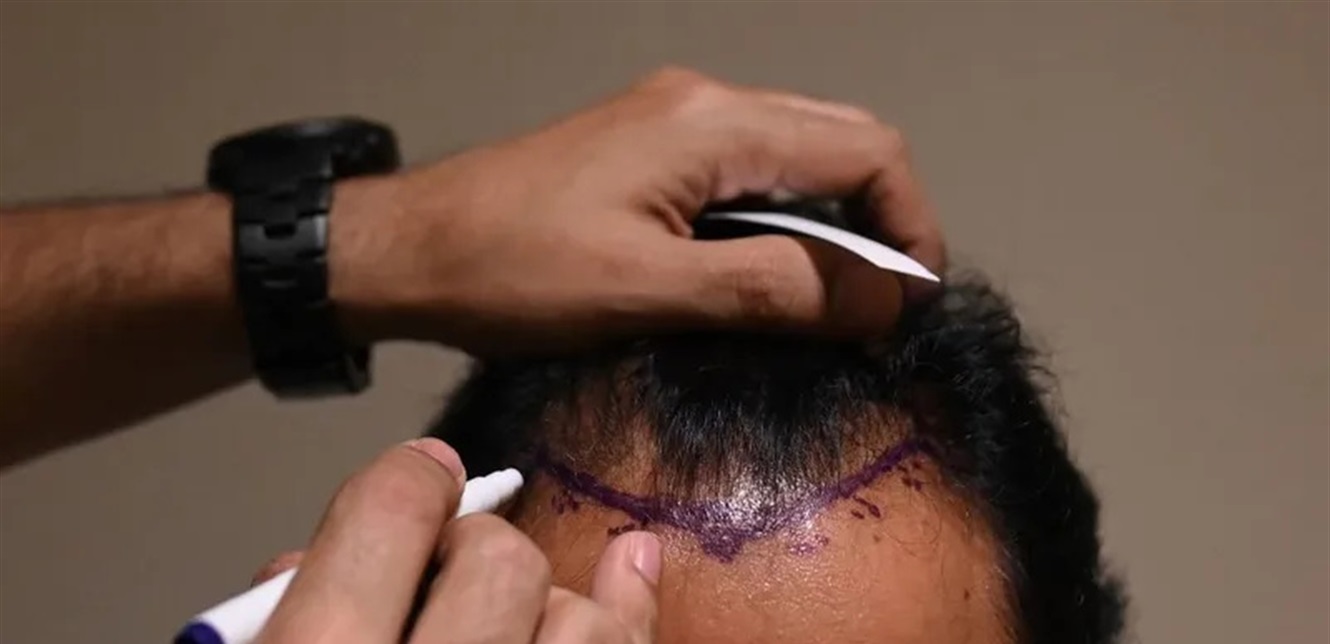 بالفيديو.. فنان معروف يكشف سر حلاقة شعره