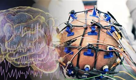 العلماء يُطورون أقطابا كهربائية لمراقبة عمل الأعصاب في الدماغ