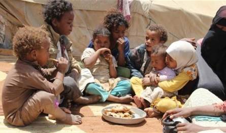 مساهمة سعودية بنحو 5 ملايين دولار لمعالجة سوء التغذية في اليمن