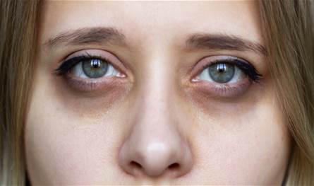 أطعمة يمكنها تحسين عملية الهضم بشكل طبيعي