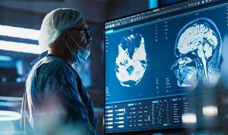 إنجاز علمي.. اكتشاف المنطقة المسؤولة عن الوعي في الدماغ