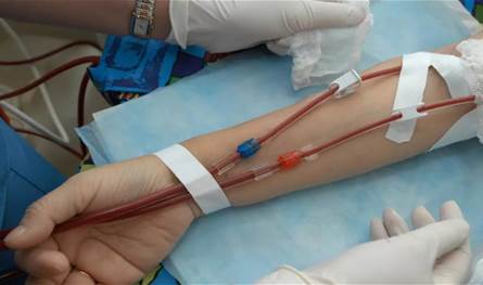 الضمان الاجتماعي يحوّل 126 مليار ليرة لتغطية علاج مرضى غسيل الكلى