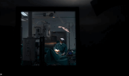 بعد جراحة القلب... هل الأسبرين مفيد أم ضار؟