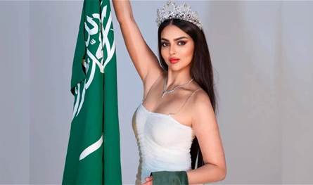 تعرّضت لتشويه في وجهها.. ملكة جمال السعودية رومي القحطاني تُفاجئ الجمهور بظهورها بإصابة بليغة! (صور)