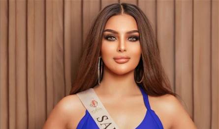 بعد تعرّضها لتشوّه في وجهها.. ملكة جمال السعودية رومي القحطاني:&quot;أنا استحملت اللي صار&quot; (صور)