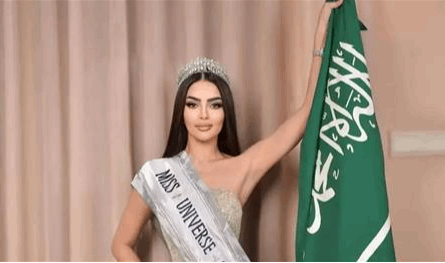 بعد تعرض وجهها للتشوه... هذا ما فعلته ملكة جمال السعودية (صورة)