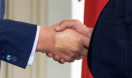 ماذا وراء الكدمات الغامضة على يد ترامب؟ خبراء يكشفون 