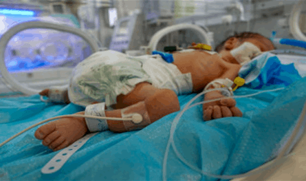  أطفال غزة يموتون بمعدلات غير مسبوقة