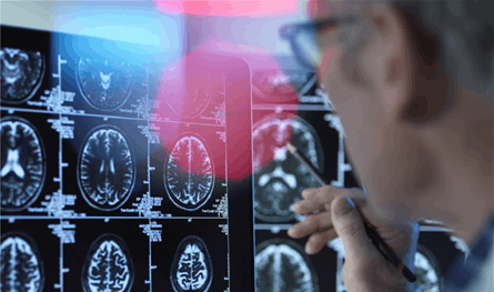 أجهزة السمع تقلّل من خطر الخرف بنسبة لافتة... دراسة حديثة تكشف