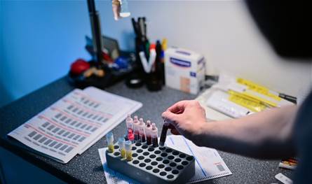  WADA توسع دائرة العقوبات في ملف المنشطات في روسيا