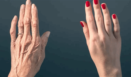 5 أطعمة تعزز الكولاجين وتقي من التجاعيد.. ما هي؟