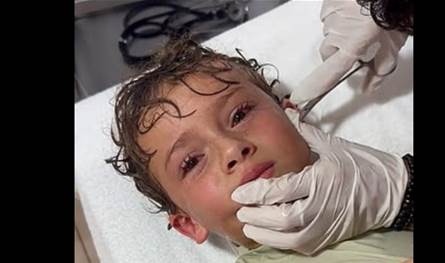 واقعة غريبة جداً.. استخراج سلطعون من أذن طفل (فيديو)