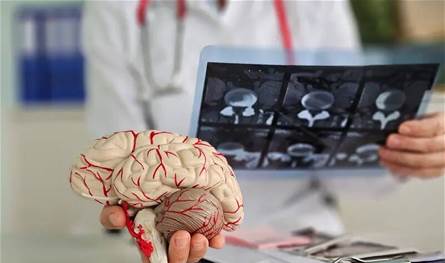 دراسة جديدة.. لهذه الاسباب أدمغة الرجال تعمل بشكل مختلف عن النساء