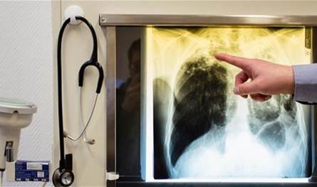  العلم يقترب من التغلب على أخطر مرض في العالم.. اليكم التفاصيل