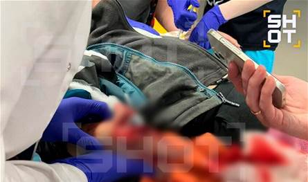 كان مخفيًا على شكل هدية… طفل يتعرض لإصابة بانفجار (صور) 