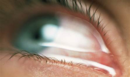 جريمة مروّعة.. امرأة تفقد بصرها بعدما سكب جيرانها مادة حارقة على وجهها