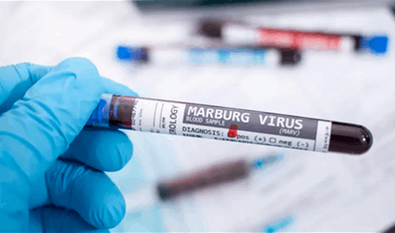 فيروس قاتل قد ينتشر... وتحذير عاجل من منظمّة الصحة العالميّة