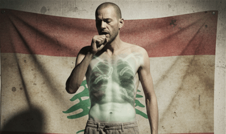 مرض السّل يضرب العالم.. ماذا عن لبنان؟