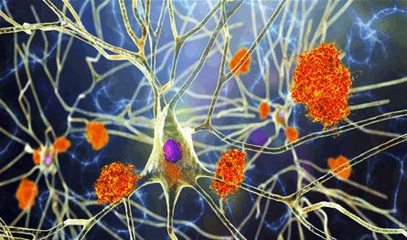 منها الفياغرا.. أدوية معروفة قد تحارب ألزهايمر ما هي؟