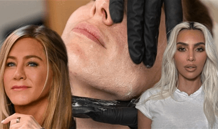 حقن السلمون تغزو عالم التجميل.. صيحة هوليوودية وسط شكوك علمية ومخاطر جلدية