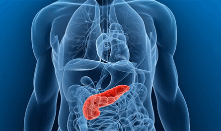 ذكاء اصطناعي في مواجهة &quot;القاتل الصامت&quot;.. أمل جديد مع سرطان البنكرياس