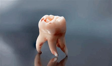 بعد خلع ضرس العقل.. 4 مشروبات يجب الابتعاد عنها