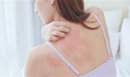 هذه الأمراض الجلدية تتفاقم في الخريف والشتاء!