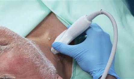 الفحص بالموجات فوق الصوتية لشرايين الرقبة يكشف امراضاً كثيرة