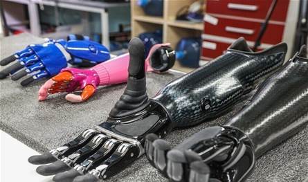 ابتكار روسي يعد بأطراف صناعية تدوم مدى الحياة