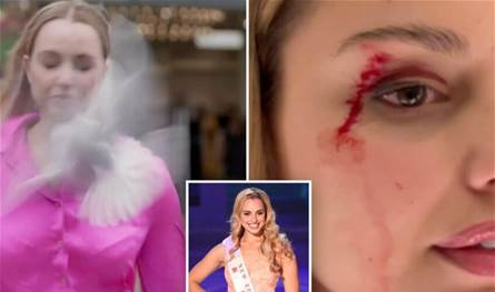 حادث غير متوقع.. طائر يهاجم مراسلة على الهواء (فيديو)