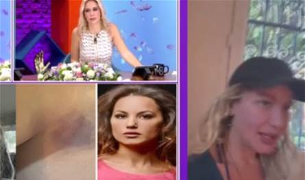 بعد 5 أشهر من الزواج… يلديز أسيالي تكشف عن تعرضها للعنف من زوجها!