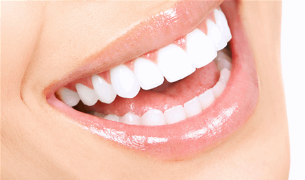 في عيادة لبنانية.. جَمّل أسنانه وهرب!