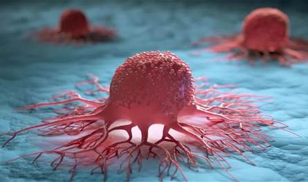 تصوير لحظة تسلّل الخلايا السرطانية إلى الدماغ للمرة الأولى