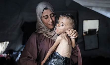 هل انتهت المجاعة في غزة؟