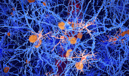 علاج جديد للصرع يقضي على النوبات ويحسن الذاكرة.. تعرف إليه