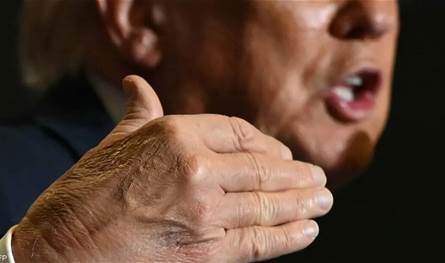 ترامب يكشف سبب كدمات يده وينفي الغفوة خلال الاجتماعات