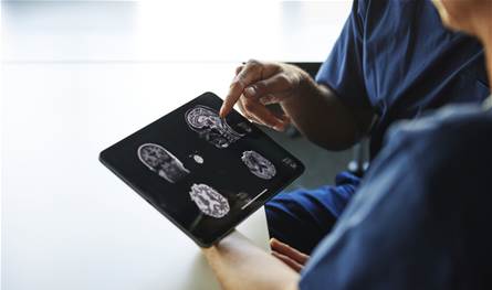 دراسة تكشف العلاقة بين حجم الرأس وخطر الخرف