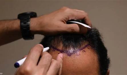 بالفيديو.. فنان معروف يكشف سر حلاقة شعره