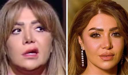 بعد أن أُصيبت بالعصب السابع.. إعلامية عربية ترد على منتقديها: "اللي مش عاجبه شكلي ميلزمنيش"